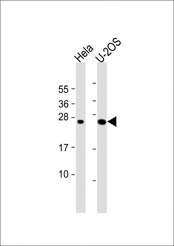 DCTN6 Antibody