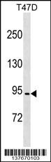 CCDC66 Antibody