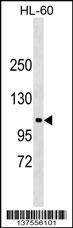 NDST3 Antibody