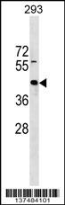 ZNF331 Antibody