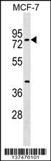 TOX4 Antibody