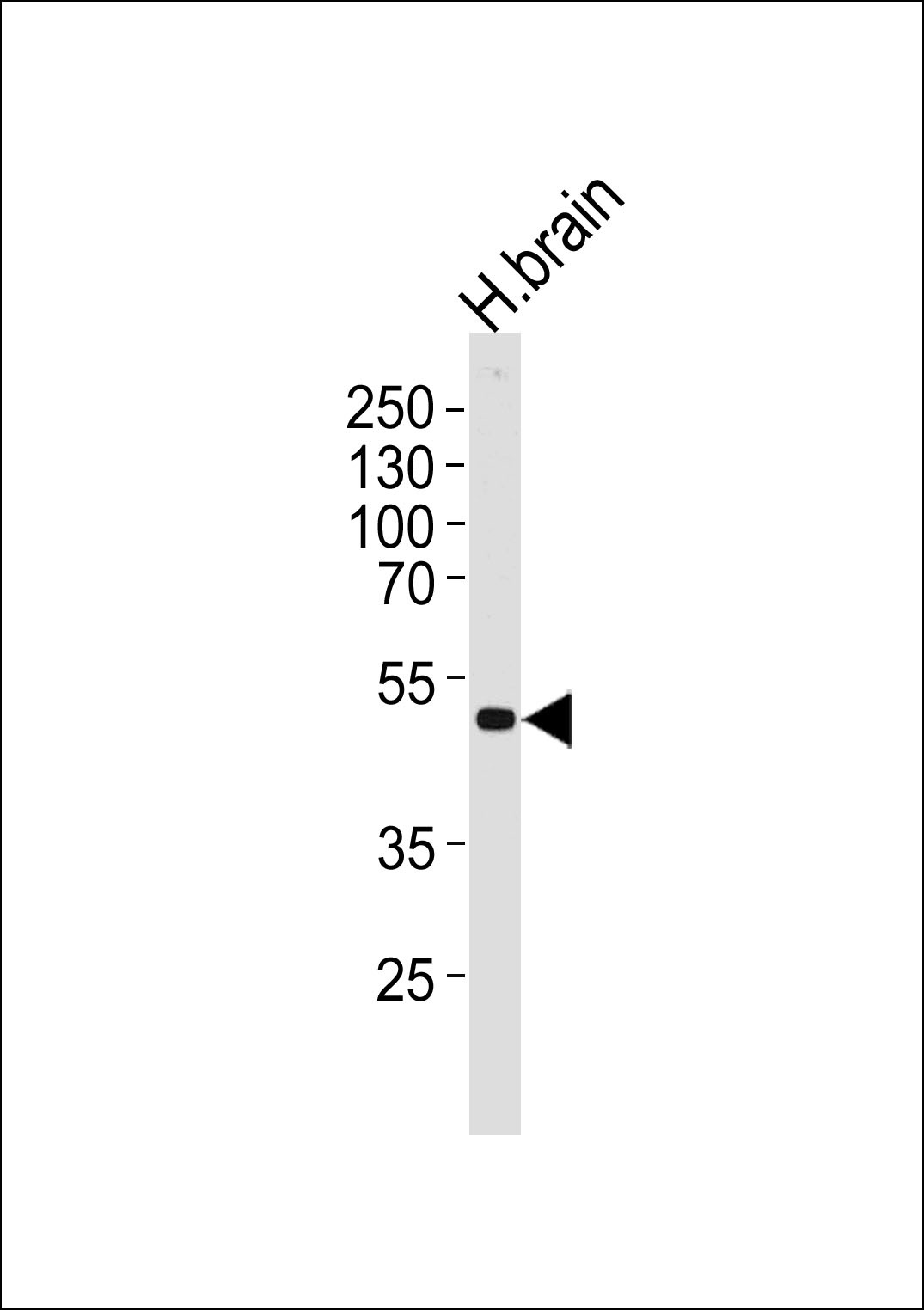 KCNJ12 Antibody