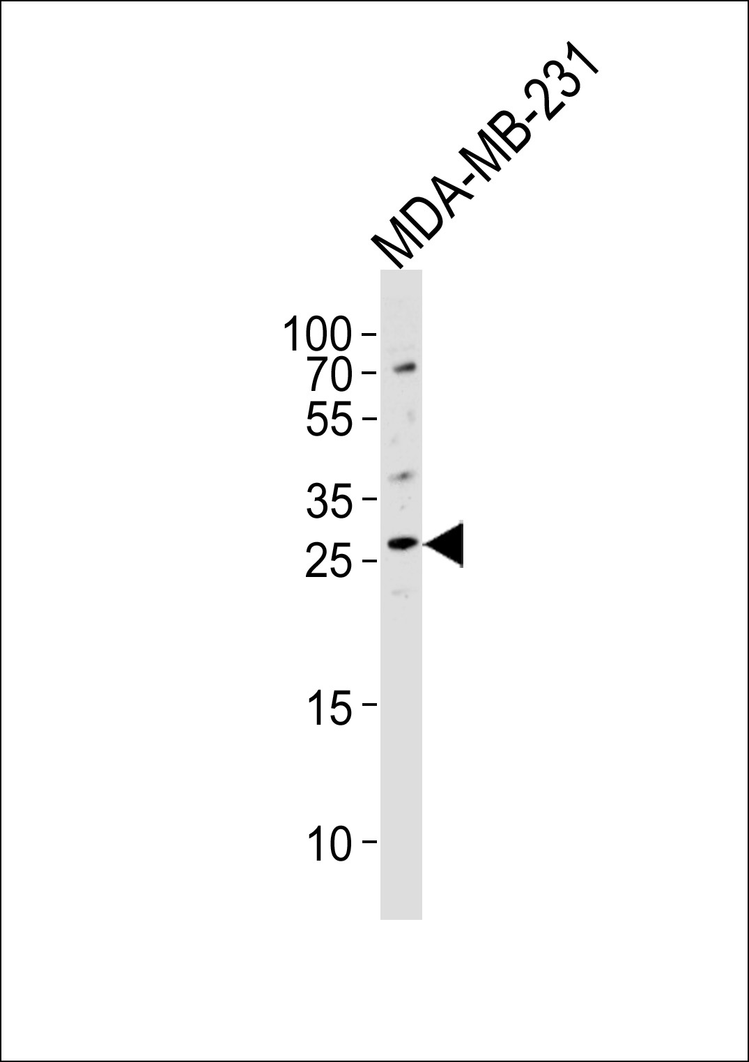 CRISP1 Antibody