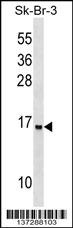 UTS2D Antibody