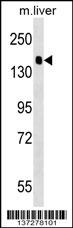 PPFIA2 Antibody