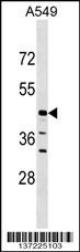 ELAC1 Antibody