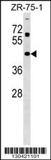 ZSCAN31 Antibody