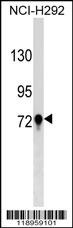 TGM3 Antibody
