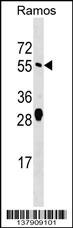 ARFGAP2 Antibody