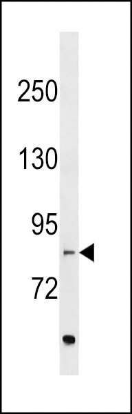 EVI5L Antibody