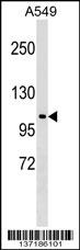 HECTD3 Antibody