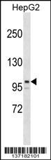 ARID5B Antibody