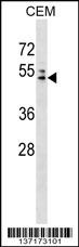 AP4M1 Antibody