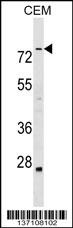 ABLIM3 Antibody