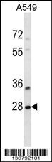 SNF8 Antibody