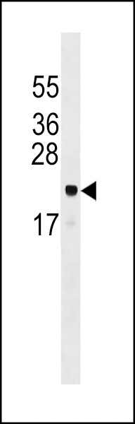 ARL6IP5 Antibody