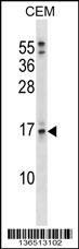 SOSTDC1 Antibody