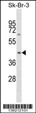 SNX7 Antibody