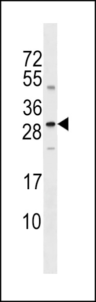 SOST Antibody