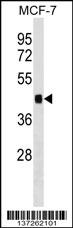 IER5 Antibody