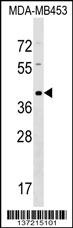 TAS2R9 Antibody