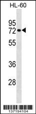 RHOT2 Antibody