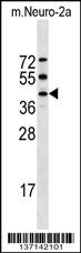 Stk32a Antibody