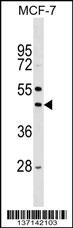 Stk32a Antibody