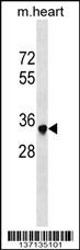Mouse Sbk2 Antibody