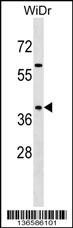 SYAP1 Antibody