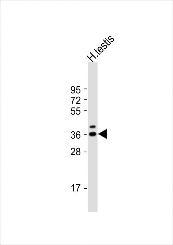 TSPY3 Antibody