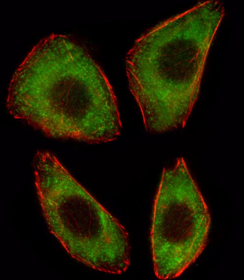 TCF25 Antibody