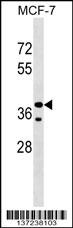 CCBE1 Antibody