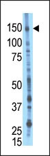 BMP2K Antibody