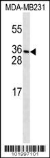 PDGFC Antibody