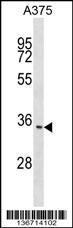 ITM2C Antibody