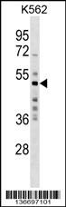 MKRN2 Antibody