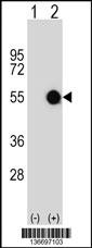 MKRN2 Antibody