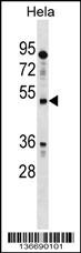 IL13RA1 Antibody