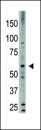 BMP6 Antibody