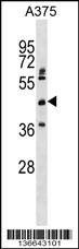 ASPHD2 Antibody