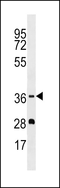 OR5M1 Antibody