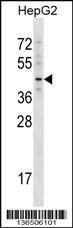 TBX20 Antibody