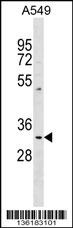 PPT1 Antibody