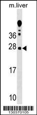 TRAT1 Antibody