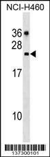 CDC42EP2 Antibody
