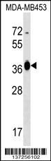 GFOD2 Antibody