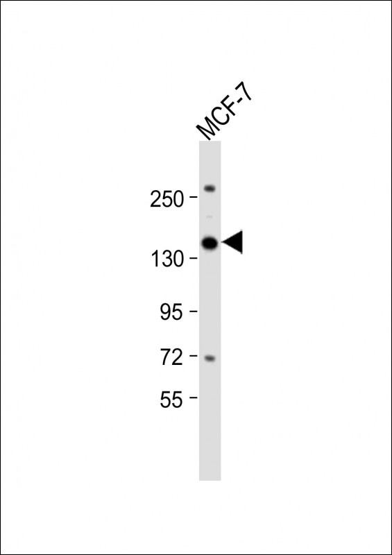 NCAPG2 Antibody