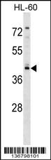 RGS11 Antibody