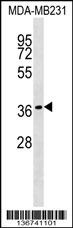 HEYL Antibody